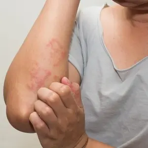 9 Ways to Lower and Manage Cortisol Levels