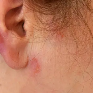 9 Ways to Lower and Manage Cortisol Levels