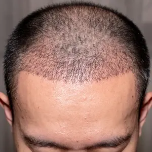 9 Ways to Lower and Manage Cortisol Levels